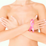 Breast Cancer