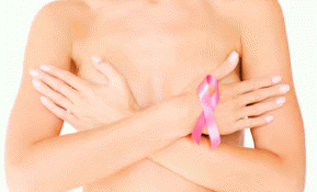 Breast Cancer