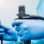 Colonoscopy