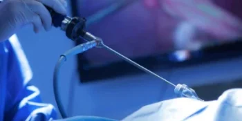 Laparoscopic Surgery